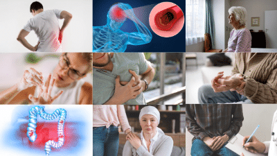 Cardiovascular disease, neurodegenerative diseases, stroke, kidney disease, and cancer caused by high levels of homocysteine and low levels of vitamin B6, B9, and B12.