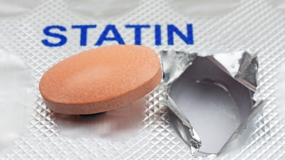 Statin, a popular cholesterol inhibitor, also inhibits the conversion of vitamin K1 to K2 in our body, likely leading to artery calcification, a common issue among patients taking statins.